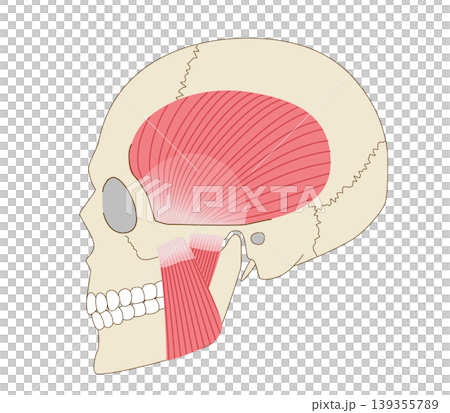 Anatomical diagram of the skull and masticatory muscles (temporalis and masseter muscles) viewed from the side. 139355789