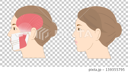 A set of anatomical illustrations comparing a woman's profile with the bones and muscles of her lower jaw. A set of anatomical illustrations comparing a woman's profile with the bones and muscles of her lower jaw. 139355795