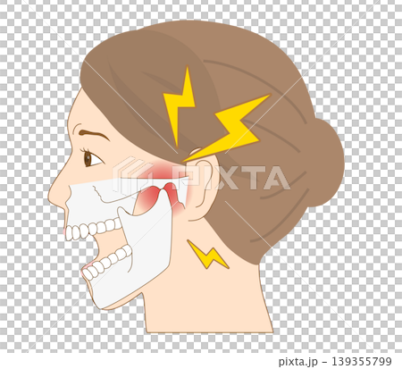 顎の痛みに悩む女性の横顔 顎関節症解剖学イラスト 139355799