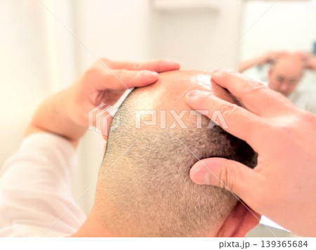 頭皮マッサージをする薄毛の中年男性 頭皮マッサージをする薄毛の中年男性 139365684