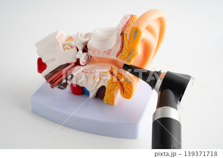 Otoscope with model for audiologist or ENT doctor use otoscope checking ear and treat hearing loss problem. Otoscope with model for audiologist or ENT doctor use otoscope checking ear and treat hearing loss problem. 139371718
