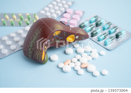 Liver model with pill drug treatment, Cirrhosis, Liver cancer, fatty liver. Liver model with pill drug treatment, Cirrhosis, Liver cancer, fatty liver. 139373004