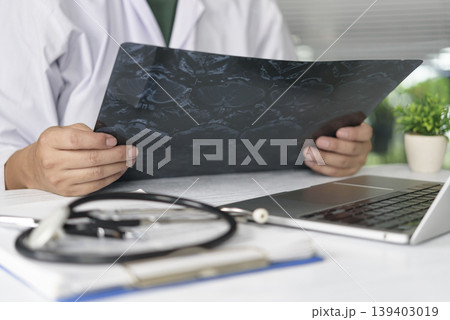 Professional doctor examining MRI brain scan film in hospital office. Neurologist or radiologist analyzing head x-ray for diagnosis of tumor or stroke. Professional doctor examining MRI brain scan film in hospital office. Neurologist or radiologist analyzing head x-ray for diagnosis of tumor or stroke. 139403019