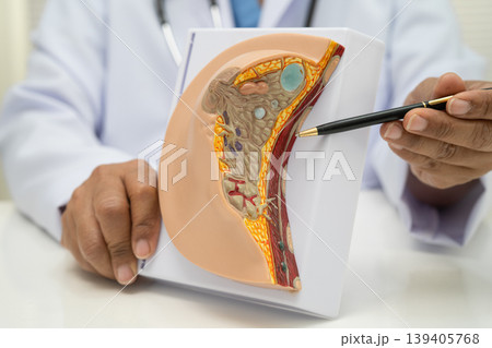 doctor holding female breast human anatomy model. 139405768