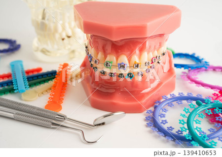 Orthodontic ligatures rings and ties, elastic rubber bands on orthodontic braces, model for dentist studying about dentistry. 139410653