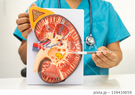Chronic kidney disease, doctor with model for treatment urinary system, urology, Estimated glomerular filtration rate eGFR. Chronic kidney disease, doctor with model for treatment urinary system, urology, Estimated glomerular filtration rate eGFR. 139410659