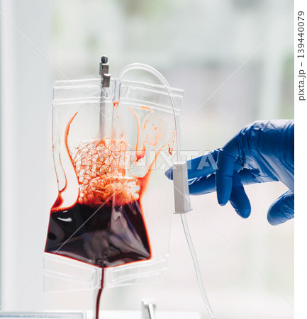A healthcare professional handles a blood bag in a medical clinic, ensuring proper preparation for patient transfusion 139440079