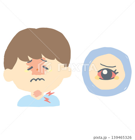 プール熱・咽頭結膜熱の症状イラスト 目の充血と喉の赤み 幼稚園 保育園 小児科 139465326