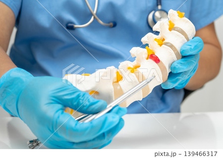 Asian doctor holding spinal nerve and bone model, Lumbar spine displaced herniated disc fragment for treatment medical in the orthopedic department. 139466317
