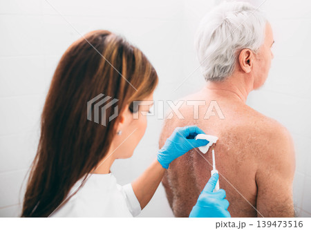 procedure removing mole to radio wave electrocoagulation method 139473516