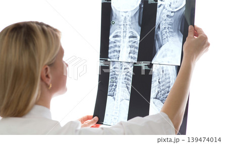 doctor examining patients x-ray and MRI scans doctor examining patients x-ray and MRI scans 139474014