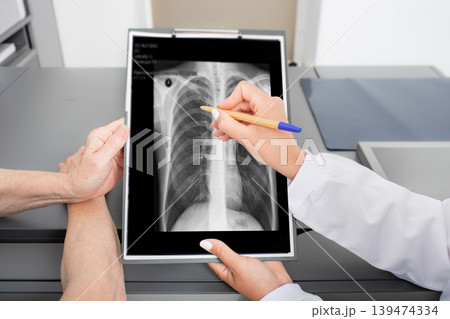 Pulmonologist showing an old patient an X-ray image of her lungs. Prevention and treatment of lung disease, pneumonia, coronavirus Pulmonologist showing an old patient an X-ray image of her lungs. Prevention and treatment of lung disease, pneumonia, coronavirus 139474334