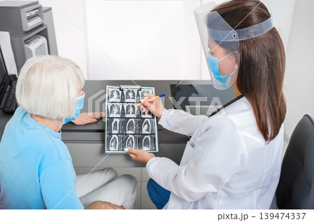 Pulmonologist showing an elderly patient a CT scan of her lungs. Pneumonia, coronavirus, lung disease 139474337