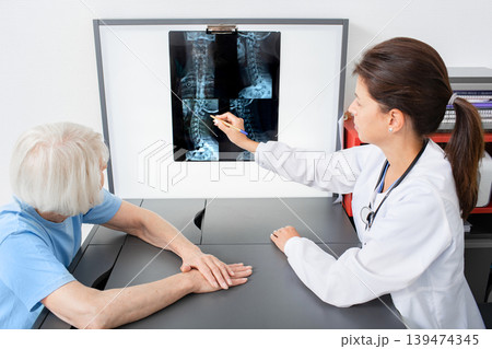 Doctor consider and discuss with senior patient an X-ray image of her cervical spine. Diagnostics and treatment of cervical osteochondrosis of the spine 139474345