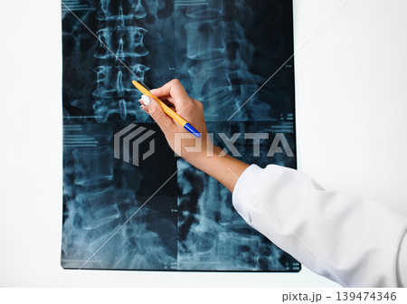 negatoscope to examines an X-ray of a patient's cervical spine. Treatment of diseases of the spine, osteochondrosis, and cervical hernia. Close-up 139474346