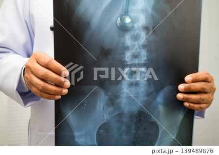 Doctor examining spine bone radiography xray film. Doctor examining spine bone radiography xray film. 139489876