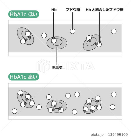 血管の中のHbA1cの状態 139499109