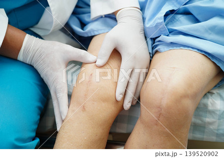 Doctor checking Asian elderly woman patient with scar knee replacement surgery in hospital. Doctor checking Asian elderly woman patient with scar knee replacement surgery in hospital. 139520902