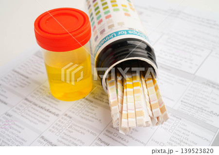 Urinalysis, urine cup with reagent strip pH paper test and comparison chart in laboratory. Urinalysis, urine cup with reagent strip pH paper test and comparison chart in laboratory. 139523820