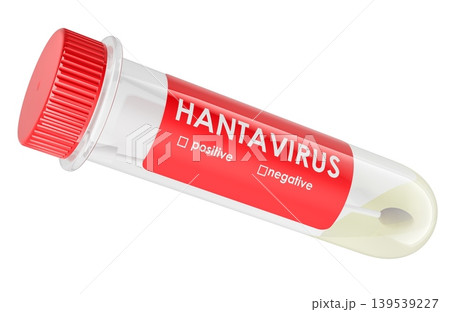 Transparent hantavirus test tube with positive negative options for laboratory diagnosis concept, 3d rendering Transparent hantavirus test tube with positive negative options for laboratory diagnosis concept, 3d rendering 139539227