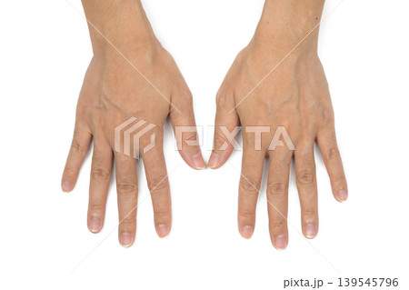Woman hand with visible blood veins on white background. Mid-digital hair as dominant gene. Hand skin with dryness and wrinkles. Need for spa or paraffin wax treatment, skincare and adult wellness. Woman hand with visible blood veins on white background. Mid-digital hair as dominant gene. Hand skin with dryness and wrinkles. Need for spa or paraffin wax treatment, skincare and adult wellness. 139545796