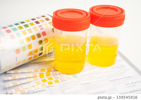 Urinalysis, urine cup with reagent strip pH paper test and comparison chart in laboratory. 139545916