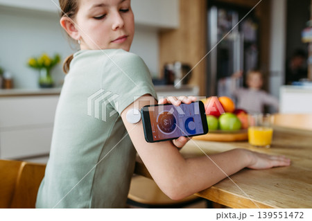 Teen girl with diabetes scanning glucose level using CGM sensor and smartphone. Teen girl with diabetes scanning glucose level using CGM sensor and smartphone. 139551472