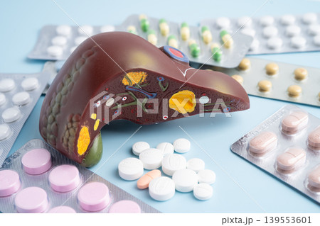 Liver model with pill drug treatment, Cirrhosis, Liver cancer, fatty liver. Liver model with pill drug treatment, Cirrhosis, Liver cancer, fatty liver. 139553601
