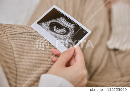 エコー写真を見つめる妊婦の手元 エコー写真を見つめる妊婦の手元 139555969