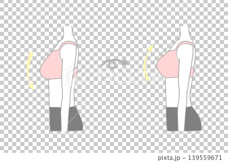 女性隆乳手術前後對比照片 139559671
