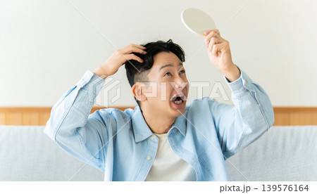 抜け毛・薄毛 髪のトラブルに悩む男性 139576164