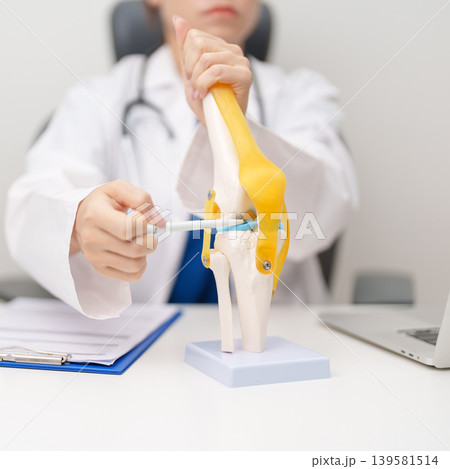 Doctor with Human Knee joint anatomy model. Osteoarthritis, Patellofemoral Pain Syndrome, Patellar Tendinitis, ACL, Anterior Cruciate Ligament, PCL, Posterior, MCL, Medial Collateral, LCL and Lateral Doctor with Human Knee joint anatomy model. Osteoarthritis, Patellofemoral Pain Syndrome, Patellar Tendinitis, ACL, Anterior Cruciate Ligament, PCL, Posterior, MCL, Medial Collateral, LCL and Lateral 139581514