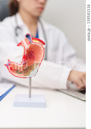 Doctor with Gastric anatomy model. Gastroenterologist consultation, stomach diseases and ulcers, November stomach cancer, Gastroesophageal Reflux Disease, GERD, Acid reflux and healthcare medical 139581516