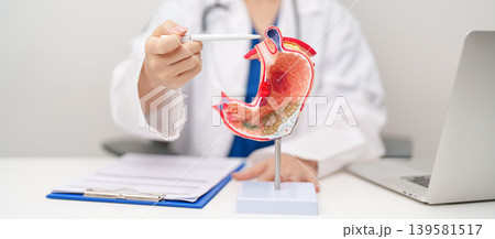 Doctor with Gastric anatomy model. Gastroenterologist consultation, stomach diseases and ulcers, November stomach cancer, Gastroesophageal Reflux Disease, GERD, Acid reflux and healthcare medical 139581517