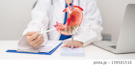 Doctor with Gastric anatomy model. Gastroenterologist consultation, stomach diseases and ulcers, November stomach cancer, Gastroesophageal Reflux Disease, GERD, Acid reflux and healthcare medical Doctor with Gastric anatomy model. Gastroenterologist consultation, stomach diseases and ulcers, November stomach cancer, Gastroesophageal Reflux Disease, GERD, Acid reflux and healthcare medical 139581518