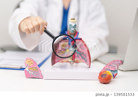 Doctor with Smoker Lung anatomy with magnifying glass. Lung Cancer, Asthma, Chronic Obstructive Pulmonary or COPD, Bronchitis, Emphysema, Cystic Fibrosis, Bronchiectasis, Pneumonia and world Lung day Doctor with Smoker Lung anatomy with magnifying glass. Lung Cancer, Asthma, Chronic Obstructive Pulmonary or COPD, Bronchitis, Emphysema, Cystic Fibrosis, Bronchiectasis, Pneumonia and world Lung day 139581533