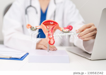 Doctor with Uterus and Ovaries anatomy model. Ovarian and Cervical cancer, Cervix disorder, Endometriosis, Hysterectomy, Uterine fibroids, Reproductive system, Pregnancy and health concept Doctor with Uterus and Ovaries anatomy model. Ovarian and Cervical cancer, Cervix disorder, Endometriosis, Hysterectomy, Uterine fibroids, Reproductive system, Pregnancy and health concept 139581542
