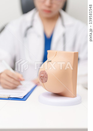 Doctor with Breast Anatomy model. Breast Augmentation Surgery, October Breast Cancer Awareness month, implant, Diagnosis, Beauty woman enlargement and medical education concept 139581548