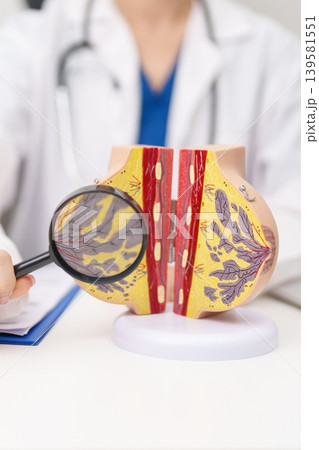 Doctor with Breast Anatomy model. Breast Augmentation Surgery, October Breast Cancer Awareness month, implant, Diagnosis, Beauty woman enlargement and medical education concept Doctor with Breast Anatomy model. Breast Augmentation Surgery, October Breast Cancer Awareness month, implant, Diagnosis, Beauty woman enlargement and medical education concept 139581551