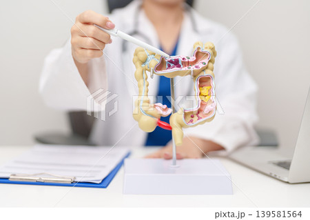 Doctor with human Colon anatomy model. Colonic disease, Large Intestine, Colorectal cancer, Ulcerative colitis, Diverticulitis, Irritable bowel syndrome, Digestive system and Healthcare concept 139581564
