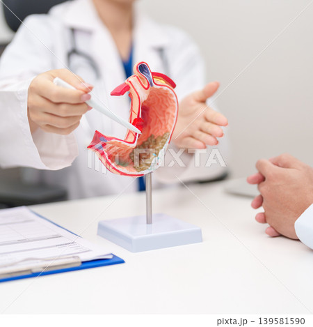 Doctor with Gastric anatomy model. Gastroenterologist consultation, stomach diseases and ulcers, November stomach cancer, Gastroesophageal Reflux Disease, GERD, Acid reflux and healthcare medical 139581590
