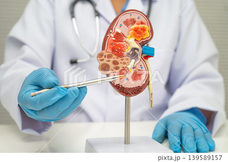 Chronic kidney disease, doctor with model for treatment urinary system, urology, Estimated glomerular filtration rate eGFR. 139589157