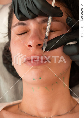 Vertical Close Up Cosmetologist Performing Facial Injection Procedure Vertical Close Up Cosmetologist Performing Facial Injection Procedure 139592917