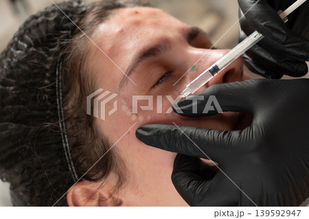 Cosmetologist Performing Facial Injection Procedure Close Up 139592947