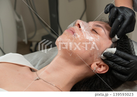 Facial Cleansing Procedure Close Up in Beauty Clinic 139593023