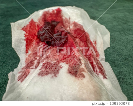 Close up of menstrual blood stain on white sanitary pad, feminine hygiene and health concept Close up of menstrual blood stain on white sanitary pad, feminine hygiene and health concept 139593078