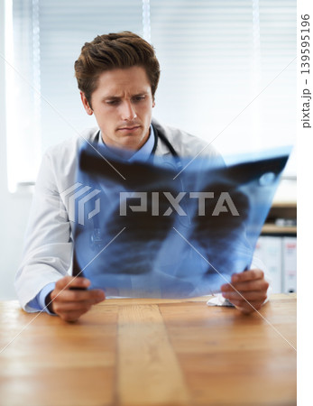 Man doctor in office and check xray, healthcare with medical diagnosis and review of lung scan at cardiology clinic. Radiology, surgeon thinking in doubt after assessment of results with MRI Man doctor in office and check xray, healthcare with medical diagnosis and review of lung scan at cardiology clinic. Radiology, surgeon thinking in doubt after assessment of results with MRI 139595196