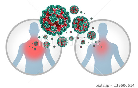 Andes Hantavirus Human Transmission Andes Hantavirus Human Transmission 139606614