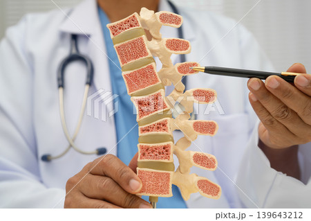 Doctor holding osteoporosis in back bone model for treatment medical in orthopedic department. Doctor holding osteoporosis in back bone model for treatment medical in orthopedic department. 139643212