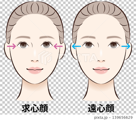 一組比較向心面和離心面的插圖(附解釋性箭頭)。 一組比較向心面和離心面的插圖(附解釋性箭頭)。 139656629